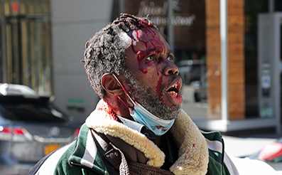 Stabbing Victim : New York : : New York :  Photos : Richard Moore : Photographer